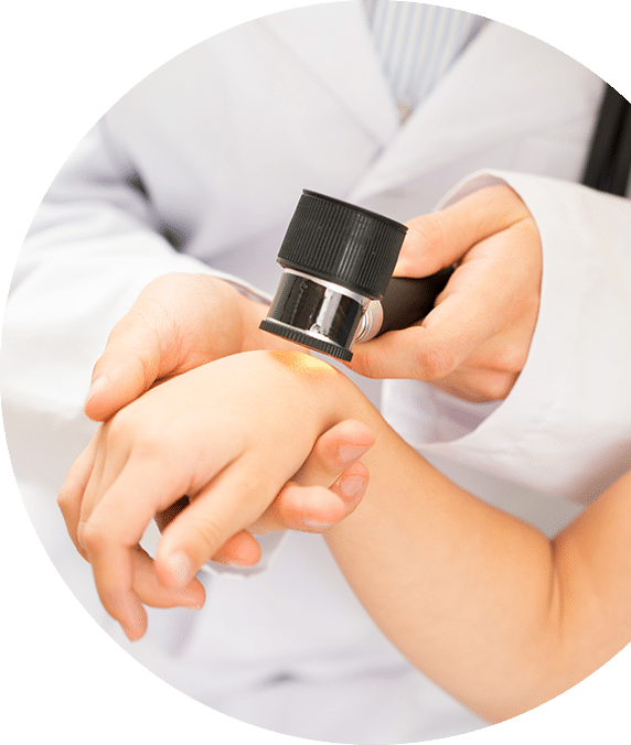 Doctor Checking Skin On Hand — Skin Doctor in Woy Woy, NSW