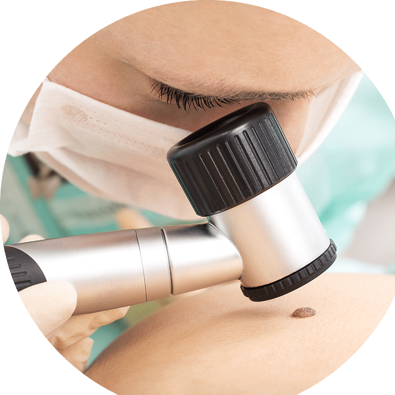 Doctor Taking A Closer Look On Patient Mole — Skin Doctor in Woy Woy, NSW